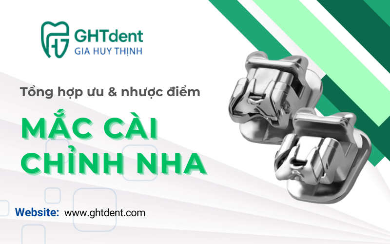 mắc cài chỉnh nha