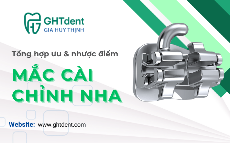 mắc cài chỉnh nha
