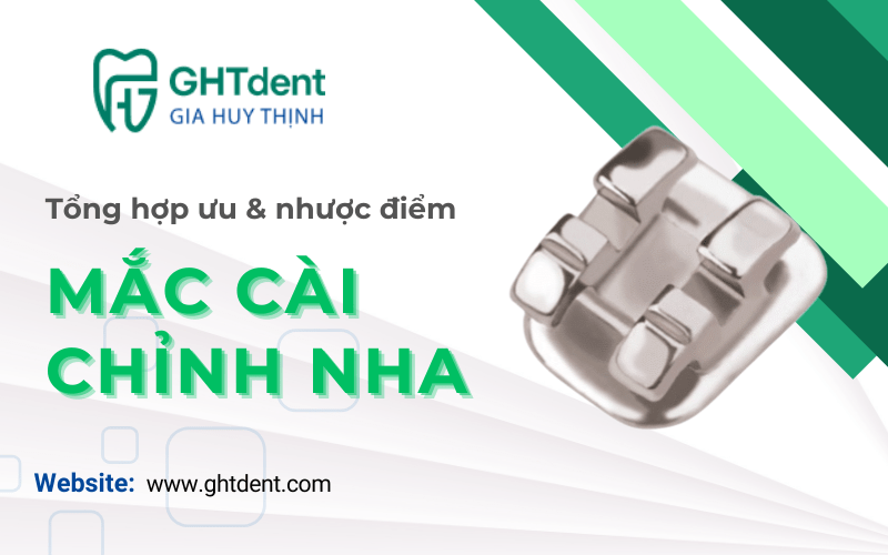 mắc cài chỉnh nha