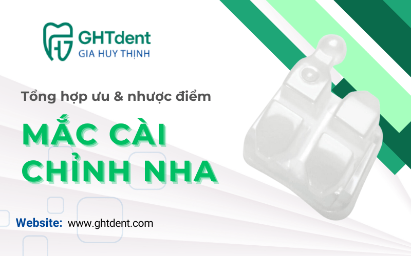 mắc cài chỉnh nha