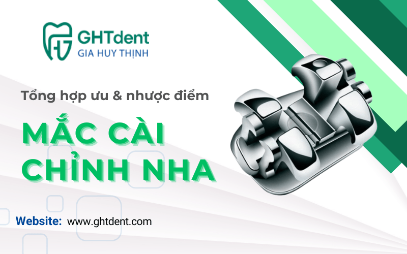 mắc cài chỉnh nha